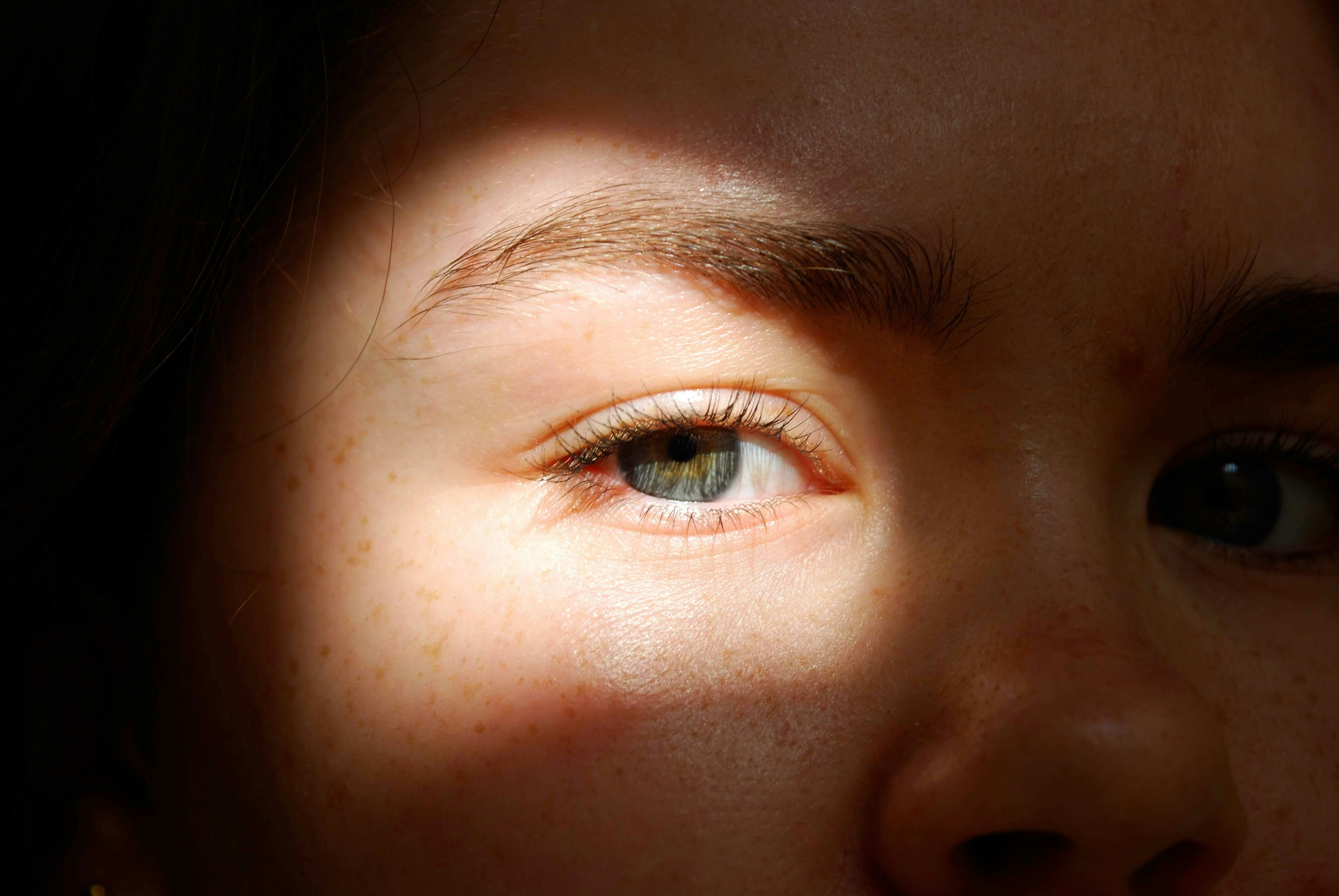 Nyári bőrápolás érzékeny bőrre ZO Skin Health termékekkel