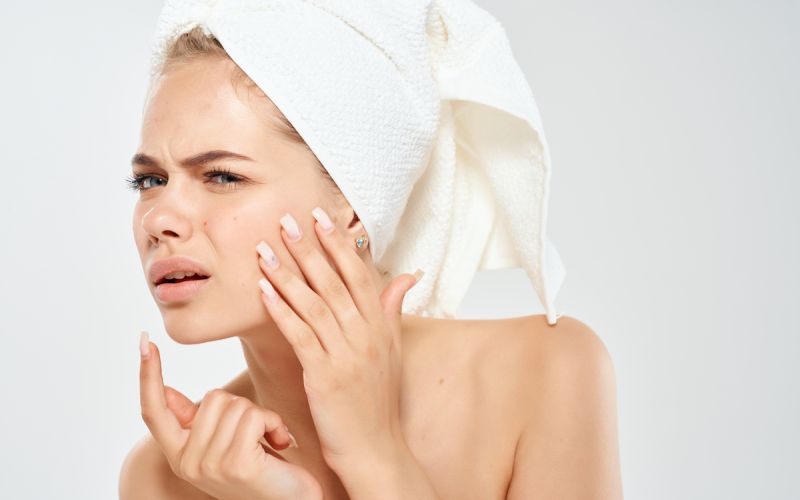Arcápolási rutin pattanásos bőrre - ZO® Skin Health módra